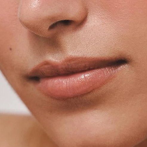 Lip flip behandeling bij House of Bratz