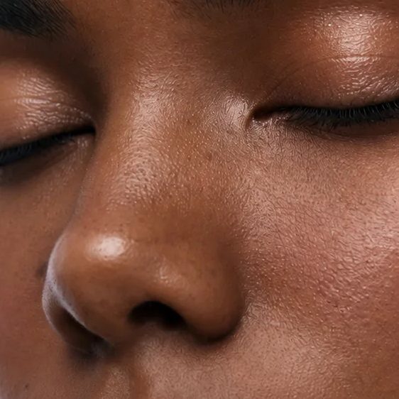 Neuspunt lift behandeling bij House of Bratz